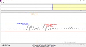 The analysis screen with Softchrono showing a velocity of 502.6 FPS.